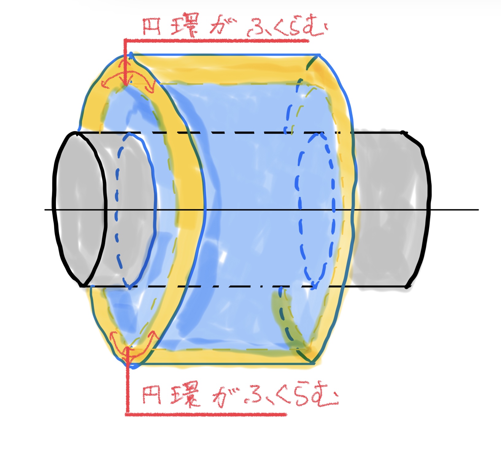 圧入による円筒の膨らみ